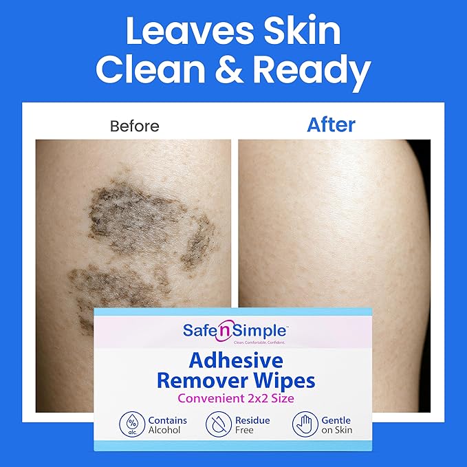 Safe n' Simple Adhesive Remover for Skin - 2”x2” 50 Packets - Adhesive Remover Wipes - Adhesive Remover Wipes Alcohol - Medical Isopropyl Alcohol Cleansing Pads Individually Wrapped