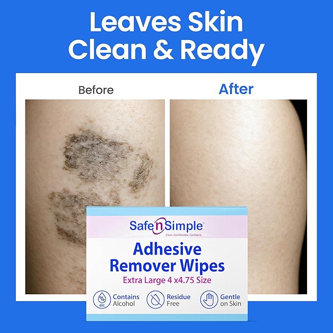 Safe n’ Simple Adhesive Remover for Skin - 50 Individually Wrapped Large 4"x4.75" Alcohol Adhesive Remover Wipes - Medical Isopropyl Alcohol Pads - Gentle Adhesive Removal Wipes for Bandages & Ostomy